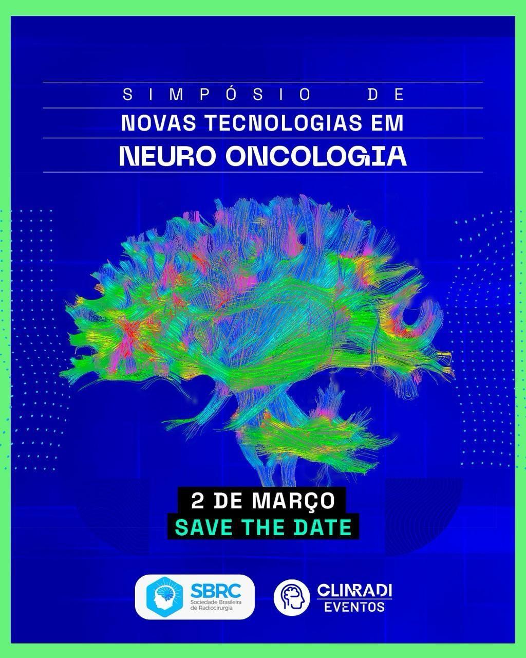 Aracaju recebe Simpósio de Novas Tecnologias em Neuro Oncologia dia 02 de março