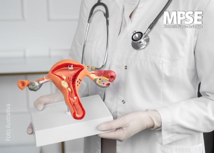 MPSE move Ação para assegurar procedimento cirúrgico para paciente com agravamento de endometriose