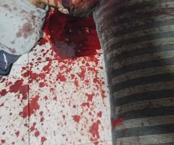 Sargento da policia militar é morto após ser tingido a pauladas em Carira