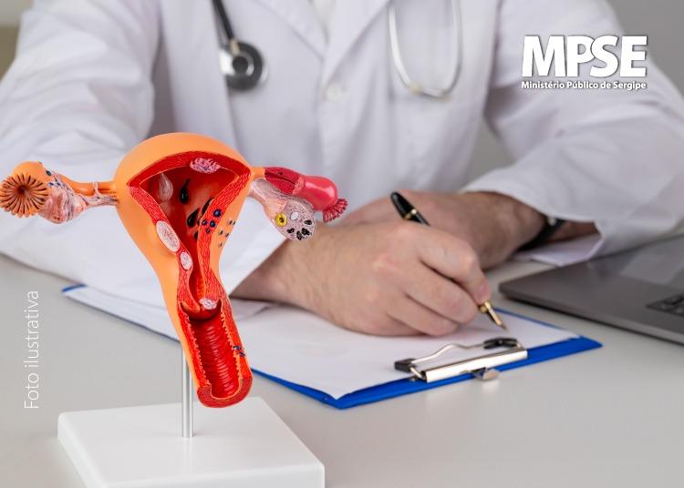 MPSE obtém decisão liminar para garantir procedimento cirúrgico de urgência para paciente com endometrioses
